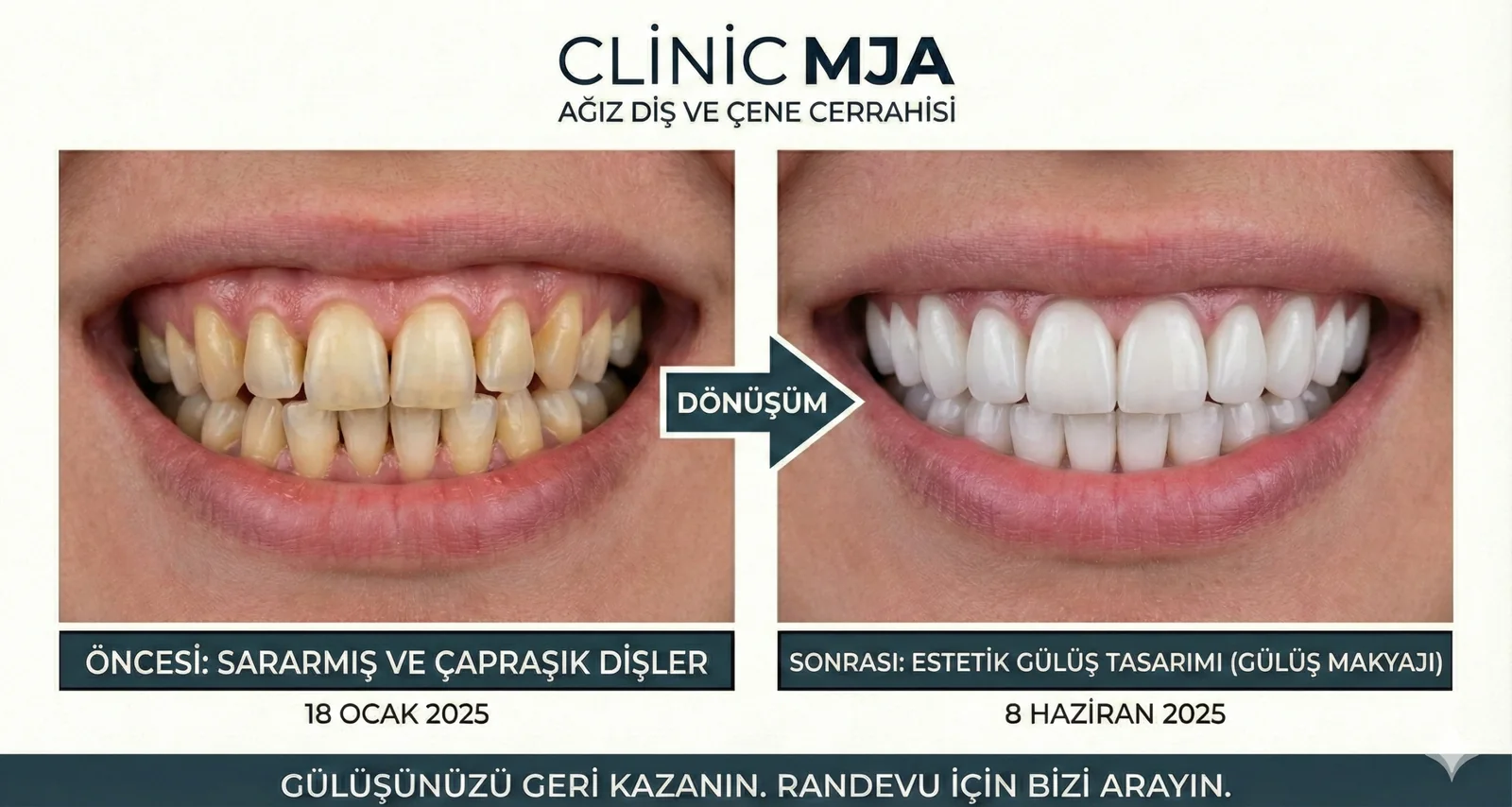 Estetik Diş Hekimliği & Gülüş Tasarımı